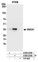 ANXA1/Annexin A1 Antibody in Immunoprecipitation (IP)