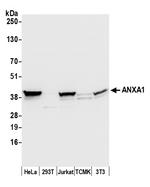 ANXA1/Annexin A1 Antibody in Western Blot (WB)