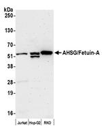 AHSG/Fetuin-A Polyclonal Antibody