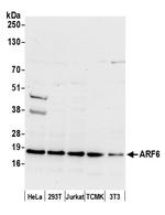 ARF6/ADP Ribosylation Factor 6 Polyclonal Antibody