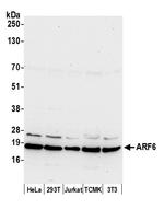 ARF6/ADP Ribosylation Factor 6 Polyclonal Antibody