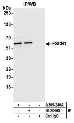 FSCN1 Antibody in Immunoprecipitation (IP)