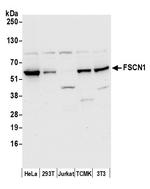 FSCN1 Antibody in Western Blot (WB)