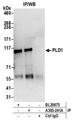 PLD1/Phospholipase D1 Polyclonal Antibody