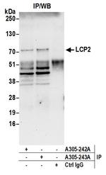 LCP2/SLP76 Antibody in Immunoprecipitation (IP)