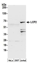 LCP2/SLP76 Polyclonal Antibody