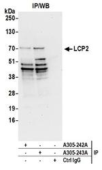 LCP2/SLP76 Antibody in Immunoprecipitation (IP)