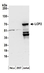 LCP2/SLP76 Polyclonal Antibody