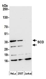 SCD/SCD1/Stearoyl-CoA Desaturase Antibody in Western Blot (WB)