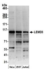 LEMD3/MAN1 Polyclonal Antibody