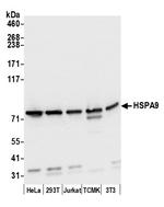 HSPA9/GRP75/Mortalin Polyclonal Antibody