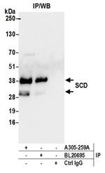 SCD/SCD1/Stearoyl-CoA Desaturase Antibody in Immunoprecipitation (IP)