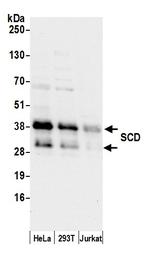 SCD/SCD1/Stearoyl-CoA Desaturase Polyclonal Antibody