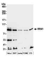 RRM1 Polyclonal Antibody