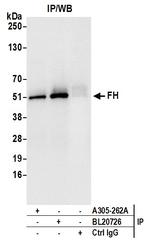 FH/Fumarate Hydratase Antibody in Immunoprecipitation (IP)