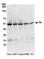 FH/Fumarate Hydratase Antibody in Western Blot (WB)