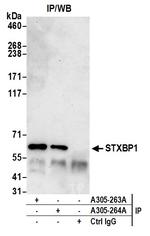 STXBP1/MUNC18-1 Antibody in Immunoprecipitation (IP)
