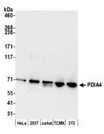 PDIA4/ERP72 Polyclonal Antibody