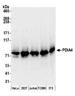 PDIA4/ERP72 Polyclonal Antibody