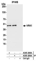 VRK1 Antibody in Immunoprecipitation (IP)