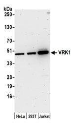 VRK1 Polyclonal Antibody