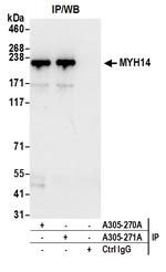 MYH14/Myosin-14 Antibody in Immunoprecipitation (IP)
