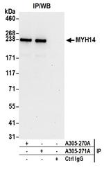 MYH14/Myosin-14 Antibody in Immunoprecipitation (IP)