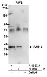 RAB10 Antibody in Immunoprecipitation (IP)