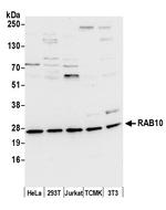 RAB10 Polyclonal Antibody
