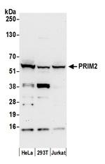 PRIM2/DNA Primase Large Subunit Polyclonal Antibody