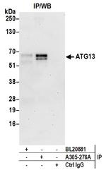 ATG13/KIAA0652 Antibody in Immunoprecipitation (IP)