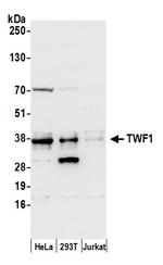TWF1/PTK9 Polyclonal Antibody
