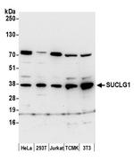 SUCLG1 Polyclonal Antibody