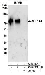 SLC1A4/ASCT1 Antibody in Immunoprecipitation (IP)
