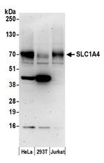 SLC1A4/ASCT1 Polyclonal Antibody