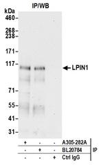 LPIN1 Antibody in Immunoprecipitation (IP)