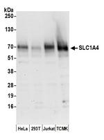 SLC1A4/ASCT1 Polyclonal Antibody