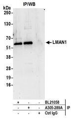 LMAN1 Polyclonal Antibody