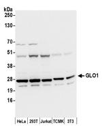 GLO1/Glyoxalase I Polyclonal Antibody