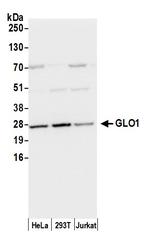 GLO1/Glyoxalase I Polyclonal Antibody