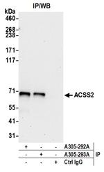 ACSS2/ACS Polyclonal Antibody
