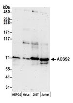 ACSS2/ACS Polyclonal Antibody