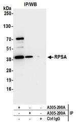 RPSA Antibody in Immunoprecipitation (IP)