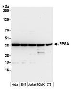 RPSA Polyclonal Antibody