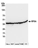 RPSA Polyclonal Antibody