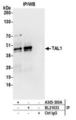 TAL1 Antibody in Immunoprecipitation (IP)