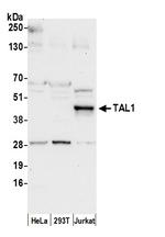 TAL1 Polyclonal Antibody