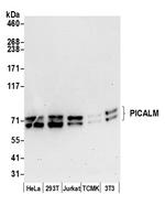 PICALM/CALM Polyclonal Antibody