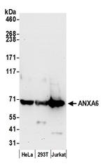 ANXA6 Polyclonal Antibody