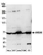 ANXA6 Polyclonal Antibody